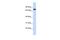 ASH2 Like, Histone Lysine Methyltransferase Complex Subunit antibody, PA5-40842, Invitrogen Antibodies, Western Blot image 