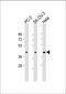 ST3 Beta-Galactoside Alpha-2,3-Sialyltransferase 4 antibody, M05863, Boster Biological Technology, Western Blot image 