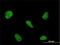RNA Binding Motif Protein 5 antibody, H00010181-M01, Novus Biologicals, Immunofluorescence image 