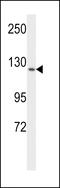 Fms Related Tyrosine Kinase 1 antibody, 63-888, ProSci, Western Blot image 
