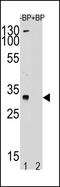 Testis Specific Protein Y-Linked 1 antibody, PA5-48721, Invitrogen Antibodies, Western Blot image 