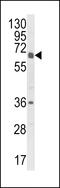 Cytochrome P450 Family 2 Subfamily C Member 18 antibody, 63-614, ProSci, Western Blot image 