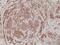 Actinin Alpha 4 antibody, MA5-27886, Invitrogen Antibodies, Immunohistochemistry paraffin image 