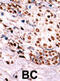 c-met antibody, abx031878, Abbexa, Immunohistochemistry paraffin image 