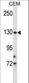 Transmembrane Serine Protease 9 antibody, LS-C162046, Lifespan Biosciences, Western Blot image 