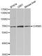 Cholinergic Receptor Muscarinic 5 antibody, LS-C335564, Lifespan Biosciences, Western Blot image 