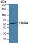 Retinoic Acid Receptor Alpha antibody, abx131535, Abbexa, Western Blot image 