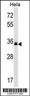 Lectin, Mannose Binding 2 antibody, 58-407, ProSci, Western Blot image 