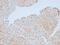 RB Transcriptional Corepressor 1 antibody, GTX34995, GeneTex, Immunohistochemistry paraffin image 