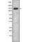 Synaptic Ras GTPase Activating Protein 1 antibody, abx218841, Abbexa, Western Blot image 