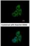 Chaperonin Containing TCP1 Subunit 8 antibody, PA5-30403, Invitrogen Antibodies, Immunofluorescence image 