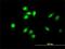 Testis Associated Actin Remodelling Kinase 2 antibody, H00010420-M01, Novus Biologicals, Immunocytochemistry image 