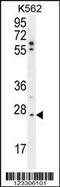 TNF Alpha Induced Protein 8 antibody, 55-533, ProSci, Western Blot image 