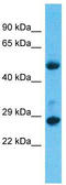Mediator Complex Subunit 6 antibody, TA343541, Origene, Western Blot image 