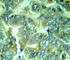 Docking Protein 1 antibody, AP0249, ABclonal Technology, Immunohistochemistry paraffin image 