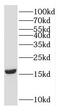 Glia Maturation Factor Gamma antibody, FNab03524, FineTest, Western Blot image 