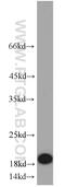 CD59 Molecule (CD59 Blood Group) antibody, 10742-1-AP, Proteintech Group, Western Blot image 