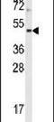 Aurora Kinase B antibody, PA5-14075, Invitrogen Antibodies, Western Blot image 