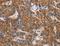 Apelin Receptor antibody, LS-C400574, Lifespan Biosciences, Immunohistochemistry frozen image 