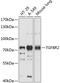 Transforming Growth Factor Beta Receptor 2 antibody, 14-136, ProSci, Western Blot image 