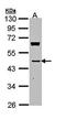 Mevalonate Diphosphate Decarboxylase antibody, orb69665, Biorbyt, Western Blot image 