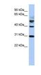 Tubulin Tyrosine Ligase antibody, NBP1-54787, Novus Biologicals, Western Blot image 