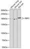 Retinol Binding Protein 3 antibody, A02913, Boster Biological Technology, Western Blot image 