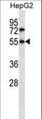 CHN antibody, LS-C162998, Lifespan Biosciences, Western Blot image 