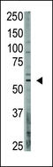 CAMP Responsive Element Binding Protein 3 Like 1 antibody, 62-191, ProSci, Western Blot image 