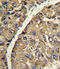 Vitronectin antibody, 62-933, ProSci, Immunohistochemistry paraffin image 