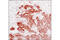c-met antibody, 8198P, Cell Signaling Technology, Immunohistochemistry frozen image 