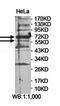 ASH2 Like, Histone Lysine Methyltransferase Complex Subunit antibody, orb78462, Biorbyt, Western Blot image 