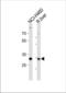 Calbindin 1 antibody, TA325174, Origene, Western Blot image 