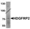 Hepatoma-derived growth factor-related protein 2 antibody, 6411, ProSci Inc, Western Blot image 