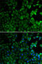 Macrophage Scavenger Receptor 1 antibody, LS-C749198, Lifespan Biosciences, Immunofluorescence image 