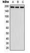 Fibulin 2 antibody, LS-C352183, Lifespan Biosciences, Western Blot image 