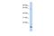 T-Complex 11 Like 2 antibody, A18041, Boster Biological Technology, Western Blot image 