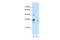 Exosome Component 3 antibody, 29-427, ProSci, Enzyme Linked Immunosorbent Assay image 