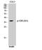Vitamin D Receptor antibody, A00210S51, Boster Biological Technology, Western Blot image 