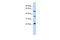 Centromere Protein M antibody, A12987, Boster Biological Technology, Western Blot image 