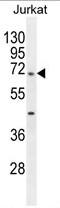 TBC1 Domain Family Member 3H antibody, AP54172PU-N, Origene, Western Blot image 