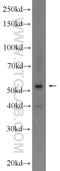 Sperm Associated Antigen 6 antibody, 12462-1-AP, Proteintech Group, Western Blot image 