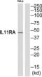 Interleukin 11 Receptor Subunit Alpha antibody, abx015086, Abbexa, Western Blot image 