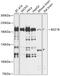 Bromodomain Adjacent To Zinc Finger Domain 1B antibody, 14-497, ProSci, Western Blot image 