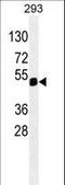 Paired Box 6 antibody, LS-C163393, Lifespan Biosciences, Western Blot image 