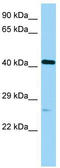 POC1 Centriolar Protein A antibody, TA334091, Origene, Western Blot image 