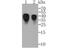 Orosomucoid 1 antibody, NBP2-76902, Novus Biologicals, Western Blot image 