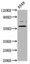 PR/SET Domain 11 antibody, CSB-PA882077LA01HU, Cusabio, Western Blot image 