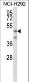 Transmembrane Serine Protease 5 antibody, LS-C162044, Lifespan Biosciences, Western Blot image 