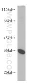 Protein Serine Kinase H2 antibody, 18813-1-AP, Proteintech Group, Western Blot image 